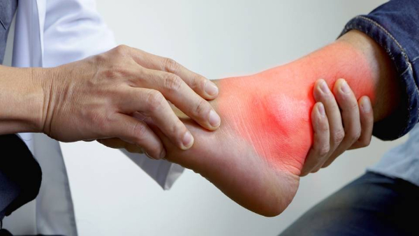 Arthritis & Rheumatology Care